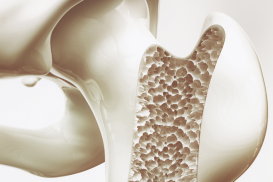 Mediathek: Osteoporose muss nicht sein! – Konzepte für gesunde Knochen bis ins hohe Alter (09.04.2025)