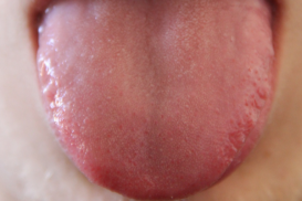 Therapie von Innen nach Außen – Cutis und Mucosa